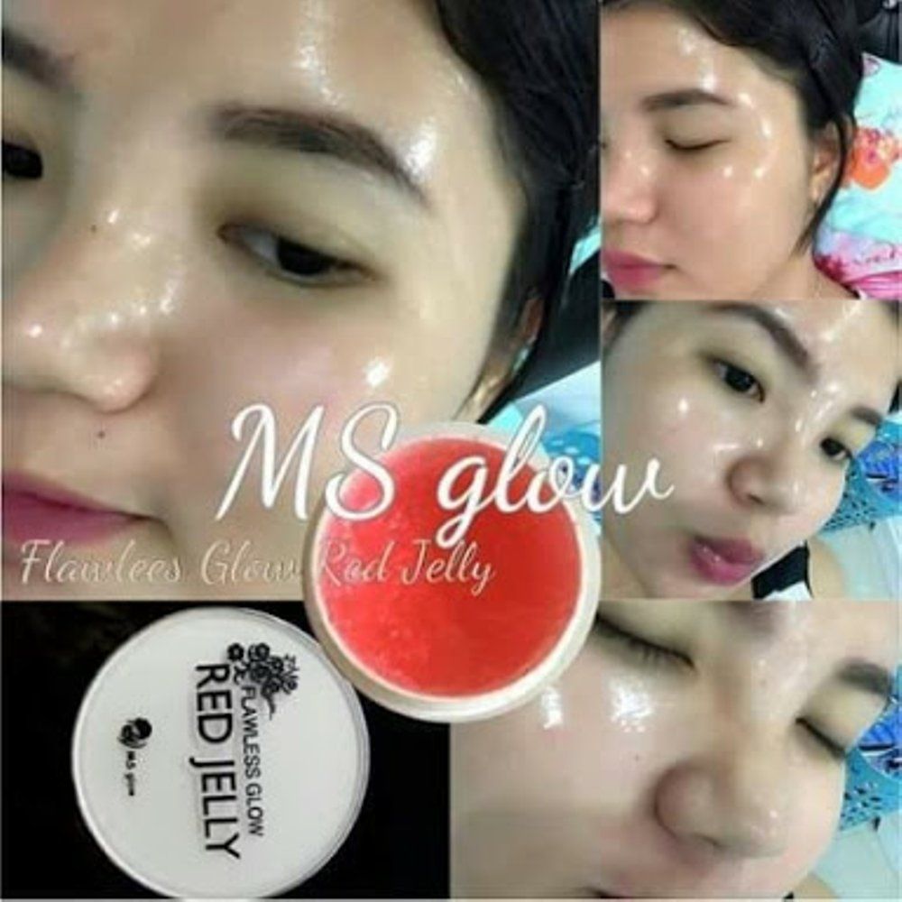 Efek Samping MS Glow Red Jelly Efek Samping MS Glow Red Jelly
