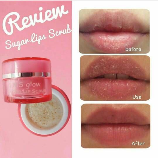 Cara Mengatasi Bibir Kering Cara Mengatasi Bibir Kering