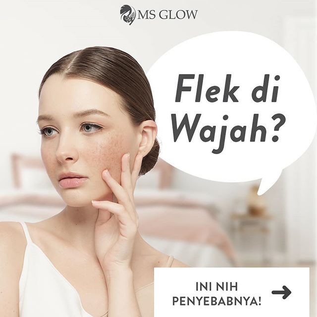 Ms Glow Ultimate: Diformulasikan Sebagai Treatment Wajah Flek Hitam Ms Glow Ultimate: Diformulasikan Sebagai Treatment Wajah Flek Hitam