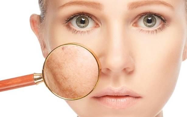 Ms Glow Ultimate Sebagai Treatment Wajah Flek Hitam? Ms Glow Ultimate Sebagai Treatment Wajah Flek Hitam?