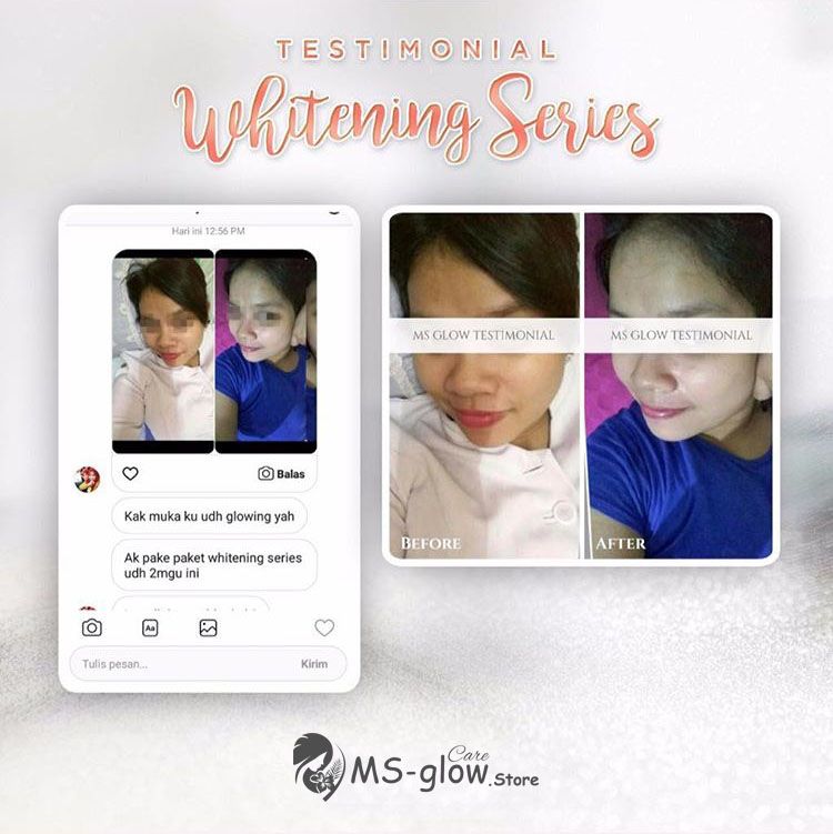 Harga Pemutih Wajah Terlaris !! Harga Pemutih Wajah Terlaris !!